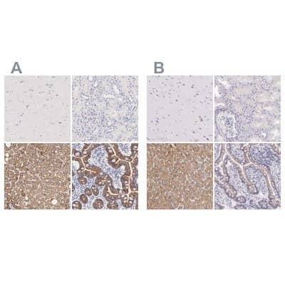Immunohistochemistry-Paraffin: Ornithine Carbamoyltransferase Antibody [NBP1-87408]