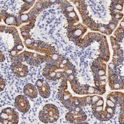 Immunohistochemistry-Paraffin: Ornithine Carbamoyltransferase Antibody [NBP1-87408]