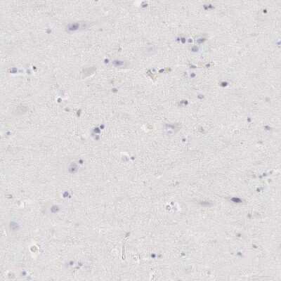 Immunohistochemistry-Paraffin: Ornithine Carbamoyltransferase Antibody [NBP1-87408]