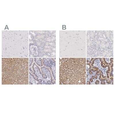 Immunohistochemistry-Paraffin: Ornithine Carbamoyltransferase Antibody [NBP1-88121]