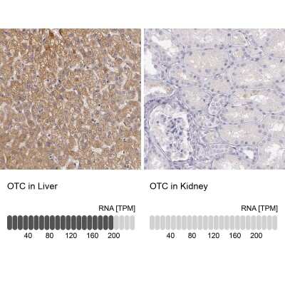 Immunohistochemistry-Paraffin: Ornithine Carbamoyltransferase Antibody [NBP1-88121]