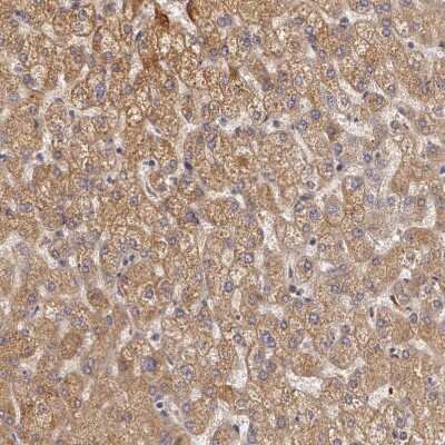 Immunohistochemistry-Paraffin: Ornithine Carbamoyltransferase Antibody [NBP1-88121]