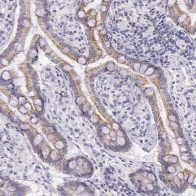 Immunohistochemistry-Paraffin: Ornithine Carbamoyltransferase Antibody [NBP1-88121]