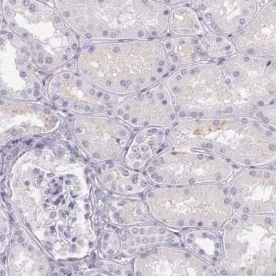 Immunohistochemistry-Paraffin: Ornithine Carbamoyltransferase Antibody [NBP1-88121]