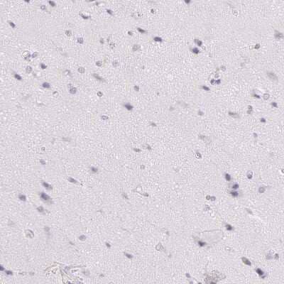 Immunohistochemistry-Paraffin: Ornithine Carbamoyltransferase Antibody [NBP1-88121]