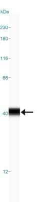 Simple Western: Ornithine Carbamoyltransferase Antibody [NBP1-87408]