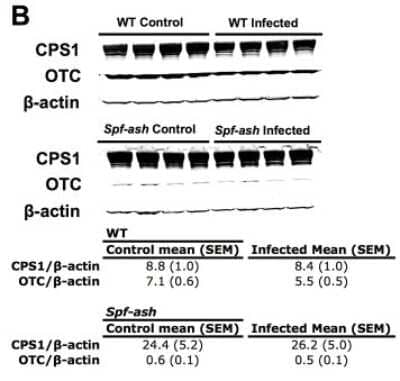 Western Blot: Ornithine Carbamoyltransferase Antibody [NBP1-31582]