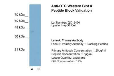 Western Blot: Ornithine Carbamoyltransferase Antibody [NBP1-54934]