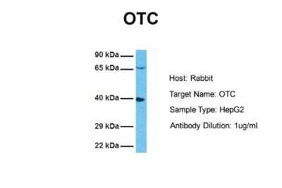 Western Blot: Ornithine Carbamoyltransferase Antibody [NBP1-54934]