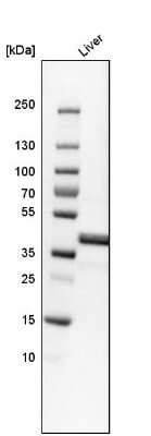 Western Blot: Ornithine Carbamoyltransferase Antibody [NBP1-87408]