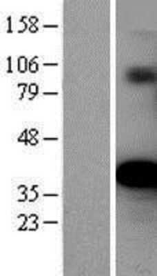 Western Blot: Ornithine Carbamoyltransferase Overexpression Lysate [NBP2-04161]