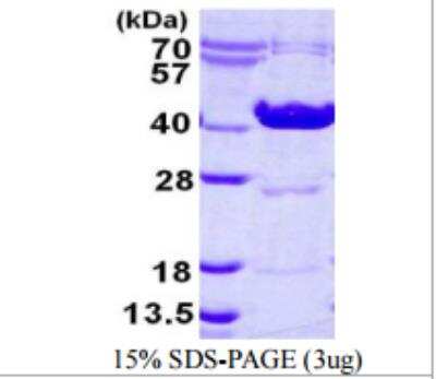 SDS-PAGE: Recombinant Human Ornithine Carbamoyltransferase His Protein [NBP1-99051]