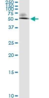 Immunoprecipitation: Ornithine Decarboxylase Antibody (2G5) [H00004953-M01]