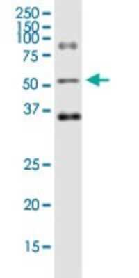 Western Blot: Ornithine Decarboxylase Antibody (2G5) [H00004953-M01]