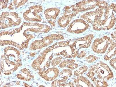 Immunohistochemistry-Paraffin: Ornithine Decarboxylase Antibody (ODC1/2878R) [NBP3-07470]