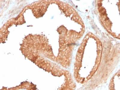 Immunohistochemistry-Paraffin: Ornithine Decarboxylase Antibody (ODC1/3636R) [NBP3-07471]