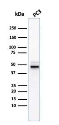 Western Blot: Ornithine Decarboxylase Antibody (ODC1/3636R) [NBP3-07471]