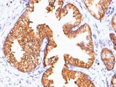 Immunohistochemistry-Paraffin: Ornithine Decarboxylase Antibody (ODC1/485) - Azide and BSA Free [NBP2-34700]