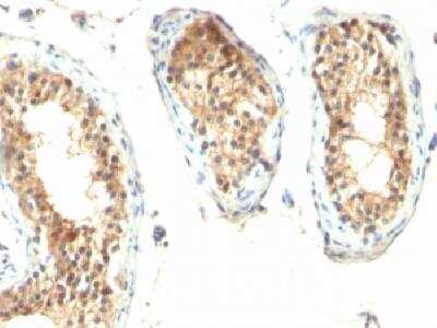 Immunohistochemistry-Paraffin: Ornithine Decarboxylase Antibody (ODC1/485) - Azide and BSA Free [NBP2-34700]