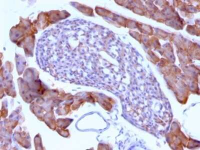 Immunohistochemistry-Paraffin: Ornithine Decarboxylase Antibody (ODC1/485) - Azide and BSA Free [NBP2-34700]