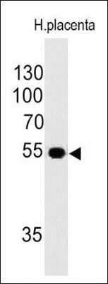 Western Blot: Ornithine Decarboxylase Antibody (ODC1/485)Azide and BSA Free [NBP2-34700]