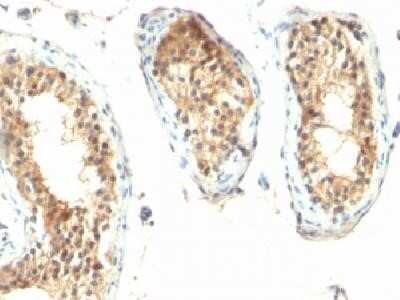 Immunohistochemistry-Paraffin: Ornithine Decarboxylase Antibody (ODC1/485) - IHC-Prediluted [NBP2-44732]