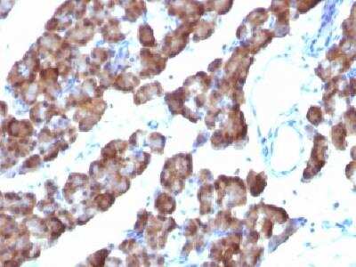 Immunohistochemistry-Paraffin: Ornithine Decarboxylase Antibody (ODC1/485) [NBP2-32887]