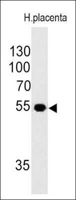 Western Blot: Ornithine Decarboxylase Antibody (ODC1/485) [NBP2-32887]