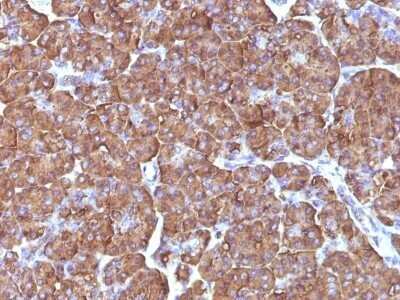 Immunohistochemistry-Paraffin: Ornithine Decarboxylase Antibody (ODC1/486) - Azide and BSA Free [NBP2-47836]