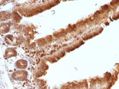 Immunohistochemistry-Paraffin: Ornithine Decarboxylase Antibody (ODC1/486) - Azide and BSA Free [NBP2-47836]