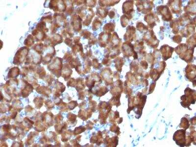 Immunohistochemistry-Paraffin: Ornithine Decarboxylase Antibody (ODC1/486) - IHC-Prediluted [NBP2-48321]