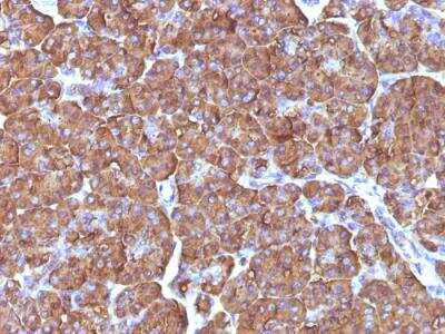 Immunohistochemistry-Paraffin: Ornithine Decarboxylase Antibody (ODC1/486) - IHC-Prediluted [NBP2-48321]