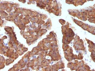 Immunohistochemistry-Paraffin: Ornithine Decarboxylase Antibody (ODC1/486) - IHC-Prediluted [NBP2-48321]