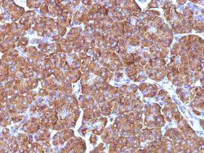 Immunohistochemistry-Paraffin: Ornithine Decarboxylase Antibody (ODC1/486) [NBP2-44734]