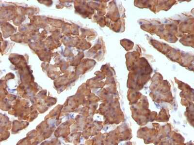 Immunohistochemistry-Paraffin: Ornithine Decarboxylase Antibody (ODC1/486) [NBP2-44734]