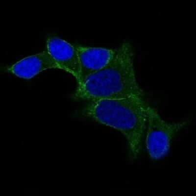 Immunocytochemistry/ Immunofluorescence: Ornithine Decarboxylase Antibody (ODC1/487) - Azide and BSA Free [NBP2-47837]