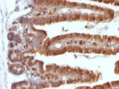 Immunohistochemistry-Paraffin: Ornithine Decarboxylase Antibody (ODC1/487) - Azide and BSA Free [NBP2-47837]