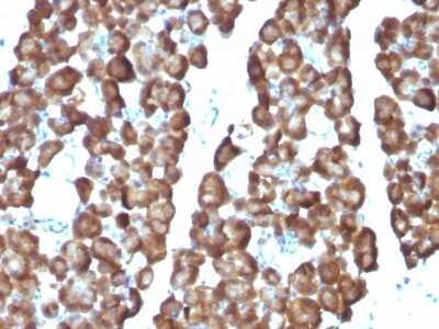 Immunohistochemistry-Paraffin: Ornithine Decarboxylase Antibody (ODC1/487) - Azide and BSA Free [NBP2-47837]