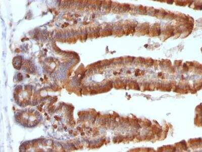 Immunohistochemistry-Paraffin: Ornithine Decarboxylase Antibody (ODC1/487) - IHC-Prediluted [NBP2-48322]