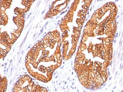 Immunohistochemistry-Paraffin: Ornithine Decarboxylase Antibody (SPM565) - Azide and BSA Free [NBP2-34800]