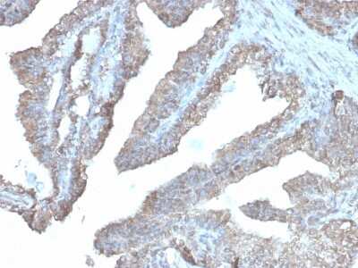 Immunohistochemistry-Paraffin: Ornithine Decarboxylase Antibody (rODC1/485) - Azide and BSA Free [NBP3-08785]