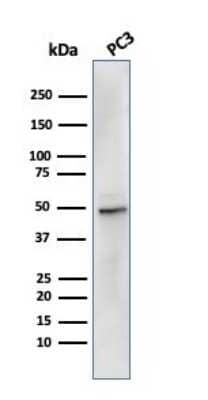 Western Blot: Ornithine Decarboxylase Antibody (rODC1/485) [NBP3-07463]