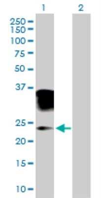 Western Blot: Orosomucoid 2 Antibody [H00005005-B01P]