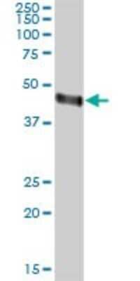 Western Blot: Orosomucoid 2 Antibody [H00005005-B01P]