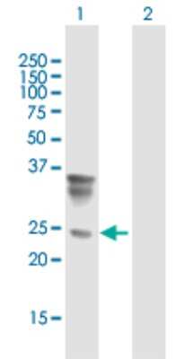 Western Blot: Orosomucoid 2 Antibody [H00005005-B01P]