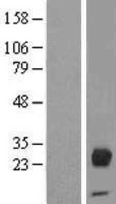 Western Blot: Orosomucoid 2 Overexpression Lysate [NBP2-10686]