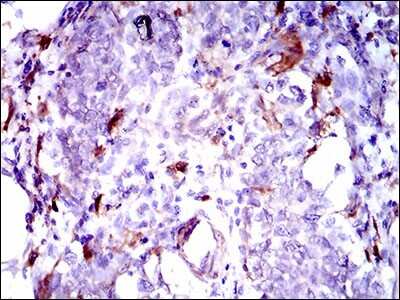 Immunohistochemistry: Osteoactivin/GPNMB Antibody (7C10E5) - BSA Free [NBP2-37351]