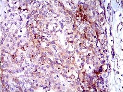 Immunohistochemistry: Osteoactivin/GPNMB Antibody (7C10E5) - BSA Free [NBP2-37351]