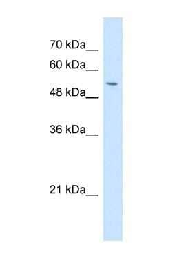 Western Blot: Osteoactivin/GPNMB Antibody [NBP1-69389]