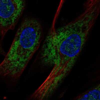 Immunocytochemistry/ Immunofluorescence: Osteoadherin/OSAD/OMD Antibody [NBP2-68892]